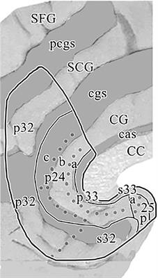 Highfield imaging of the subgenual anterior cingulate cortex in uni- and bipolar depression